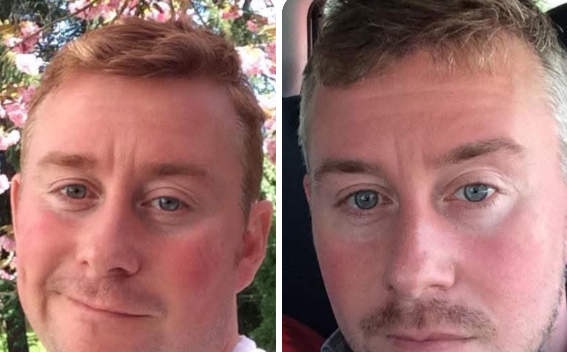 Fall River Man Killed in Late-Night Motorcycle Crash in Westport